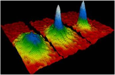 A Novel Prediction Model for Brain Glioma Image Segmentation Based on the Theory of Bose-Einstein Condensate